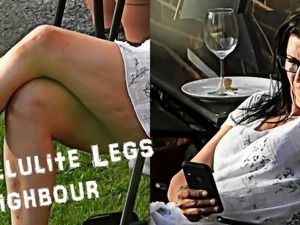 001 - Cellulite Legs Neighbour (NW Series)